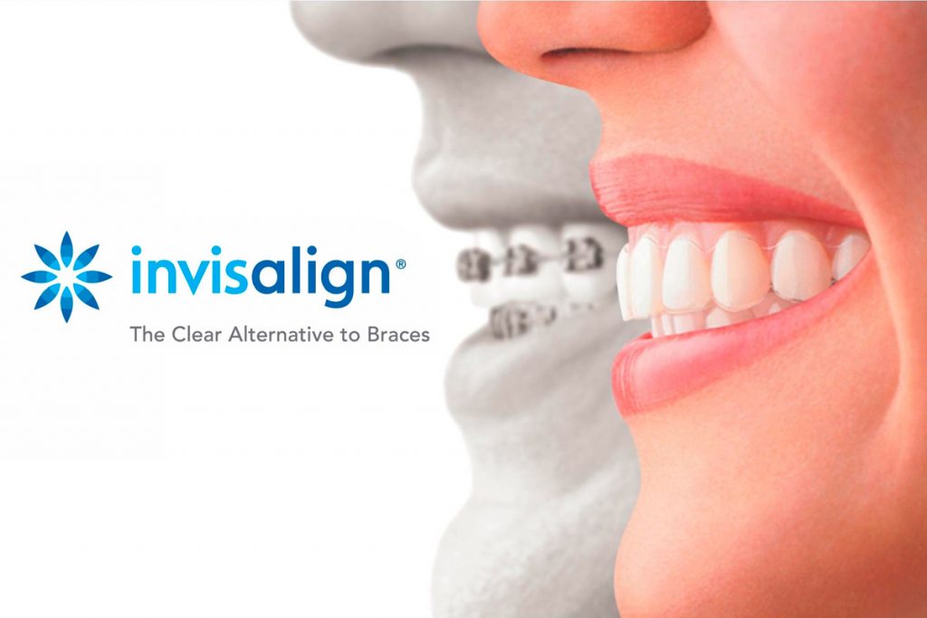 Juárez Clínica Dental Invisalign + Escáner Intraoral ITERO, El Gran ...